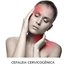 cefaleia-cervicogenica